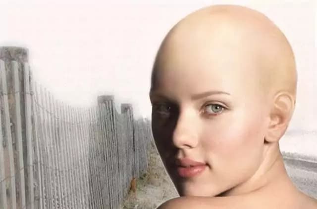 Le più belle star senza capelli