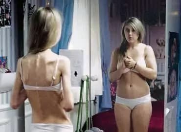 Basta modelle anoressiche: ecco una legge che vieta di essere troppo magre