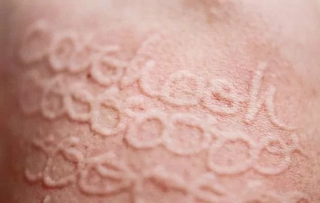 Donna colpita da rara malattia della pelle trasforma il suo corpo in una tela (FOTO e VIDEO)