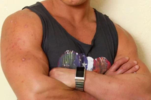 “Gli steroidi mi hanno trasformata in un uomo” [FOTO]