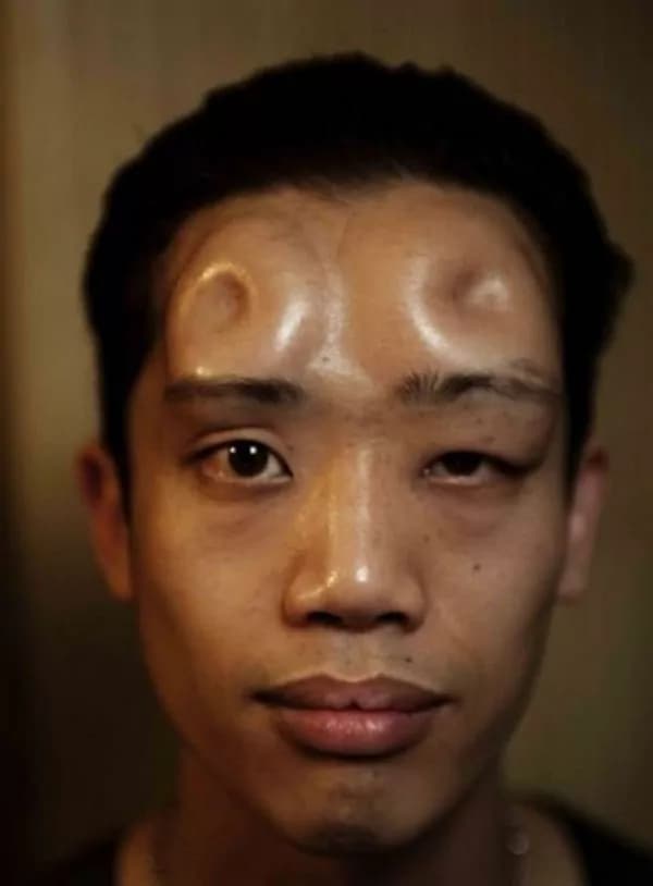 Bagel Heads: la moda giapponese di iniettarsi ciambelle sotto la pelle