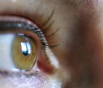 Orzaiolo: cause, soggetti a rischio, rimedi naturali e farmacologici per eliminarlo