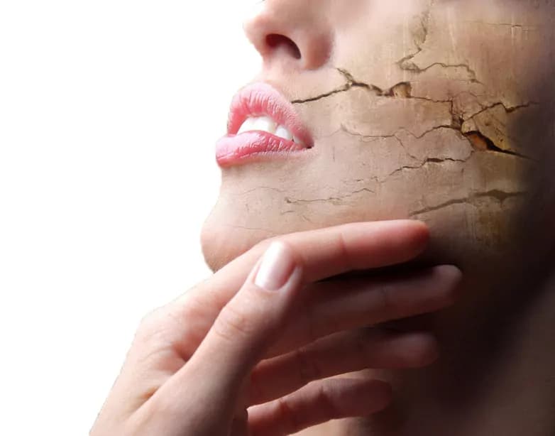 Pelle secca: cause, rimedi naturali e farmacologici per contrastarla