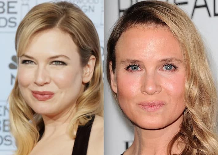 Renee Zellweger trasformata dalla chirurgia estetica [FOTO]