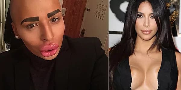 Ragazzo spende 100mila sterline per assomigliare a Kim Kardashian [FOTO]