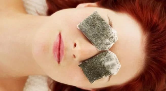 Occhiaie e borse, come eliminarle in maniera naturale ed efficacissima [VIDEO]
