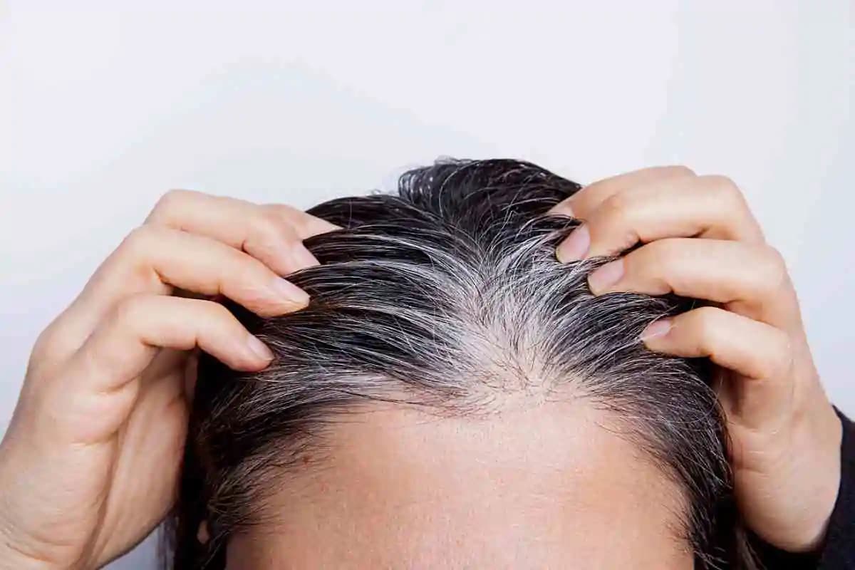 Capelli bianchi