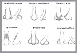Nose-xxxxxxxxxxxxxxxxxxxxxxxxxxx