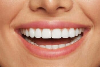 Sbiancare i denti con prodotti naturali