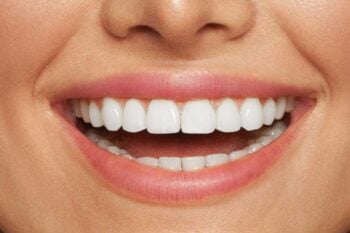 Sbiancare i denti con prodotti naturali