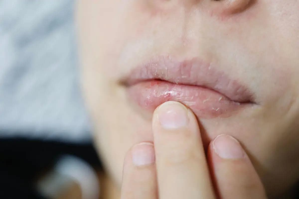prodotto per labbra sottili e screpolate