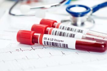 ora serve solo un esame del sangue per avere tutto sotto controllo